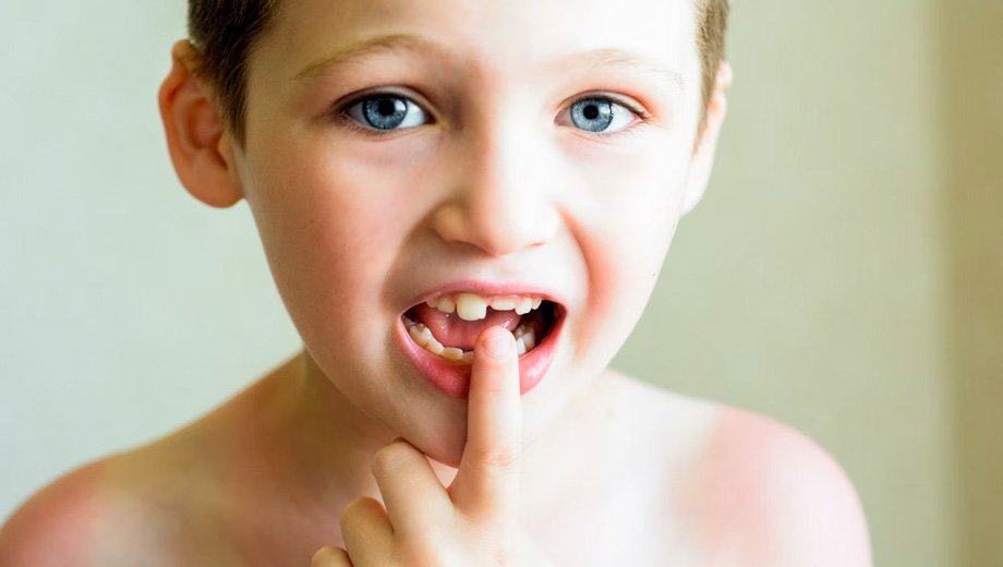 tooth restorations in Katy